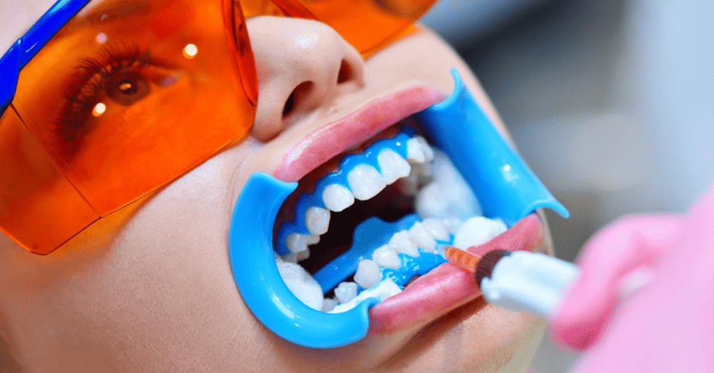Whitening your teeth at a dentist